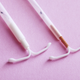 Image for article titled Will IUDs Ever Catch on in America?